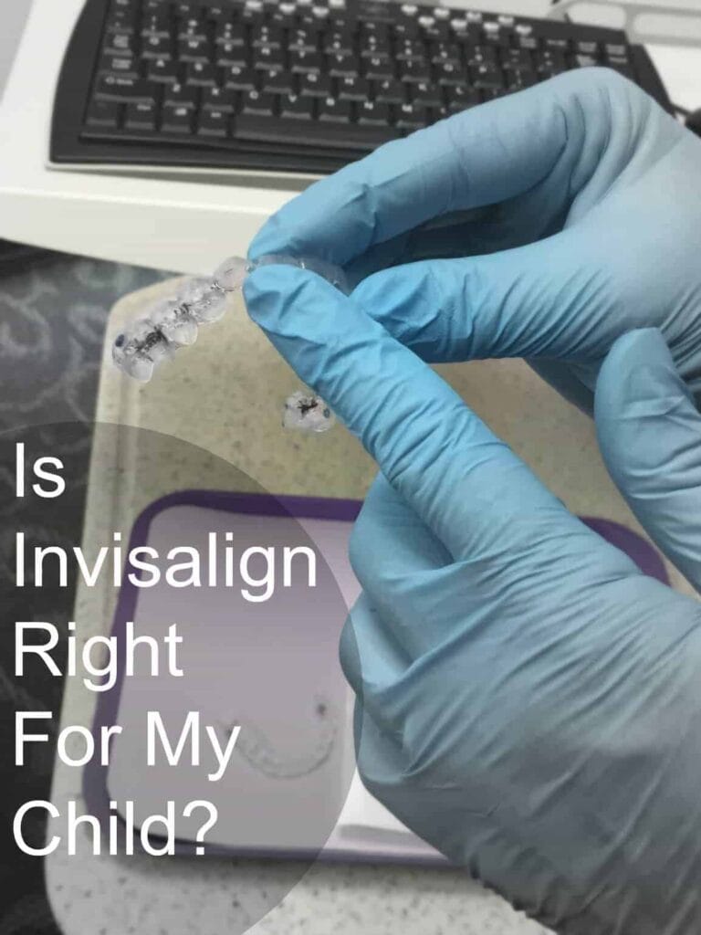 Is Invisalign right for my child? Did you know children can wear Invisalign liners?